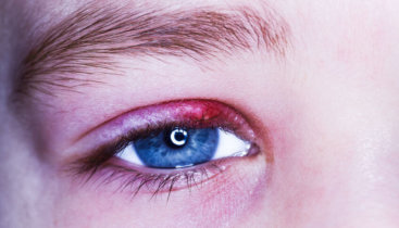 שעורה בעין שעורה בעין