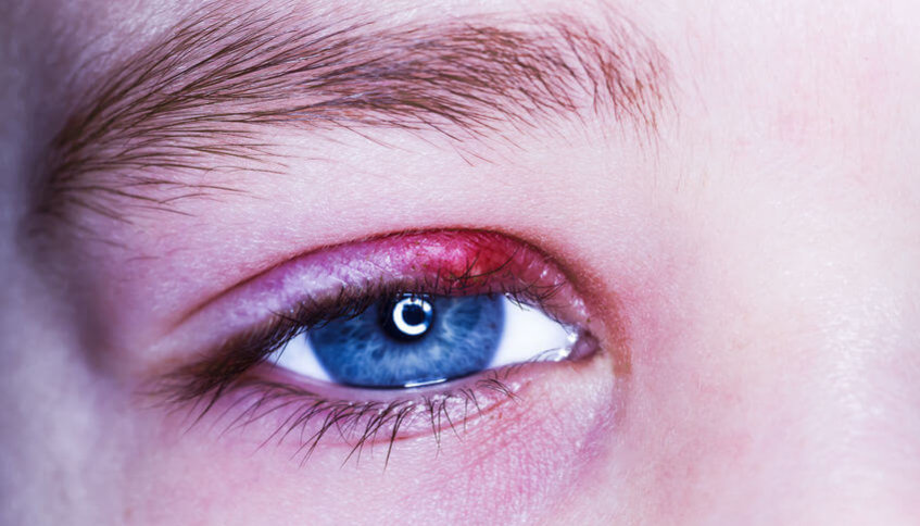 שעורה בעין שעורה בעין